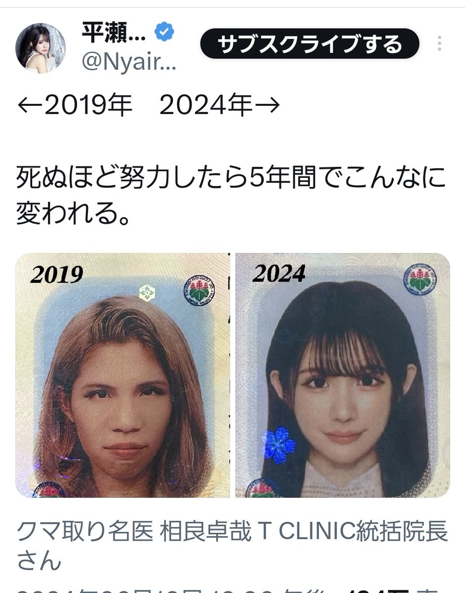 パスポートの写真拝見しました。 平瀬さん、メークだけの術前でも綺麗