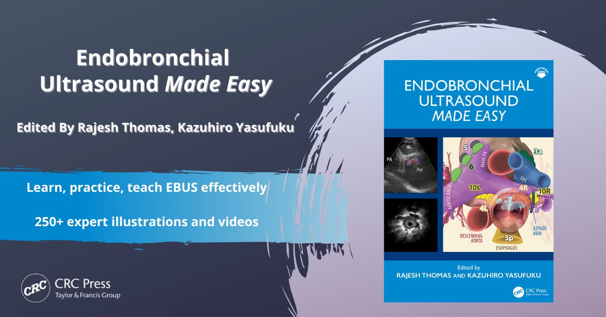 For the Love of Bronchoscopy (@abronchoscopist) on Twitter photo #EBUSMadeEasy Textbook – Released Now!
#EBUS #MadeEasy
<a href="/arash_badiei/">Arash Badiei</a>
<a href="/CalvinSidhu/">CalvinJ S</a>
<a href="/carlalambWiIP/">carla lamb</a>
<a href="/DanSteinfort/">Daniel Steinfort</a>
<a href="/MaldonadoFabien/">Fabien Maldonado 🇺🇸🇫🇷</a>
<a href="/mona_sarkiss/">Mona Sarkiss</a>
<a href="/Int_Pulmonology/">Momen Wahidi, MD, MBA</a>
<a href="/nc_huan/">Nai-Chien Huan</a>
<a href="/SKAvasarala/">Sameer Avasarala</a>
<a href="/ShivangiPraman1/">Shivangi Pramanik</a> #EBUSMadeEasy Textbook – Released Now!
#EBUS #MadeEasy
<a href="/arash_badiei/">Arash Badiei</a>
<a href="/CalvinSidhu/">CalvinJ S</a>
<a href="/carlalambWiIP/">carla lamb</a>
<a href="/DanSteinfort/">Daniel Steinfort</a>
<a href="/MaldonadoFabien/">Fabien Maldonado 🇺🇸🇫🇷</a>
<a href="/mona_sarkiss/">Mona Sarkiss</a>
<a href="/Int_Pulmonology/">Momen Wahidi, MD, MBA</a>
<a href="/nc_huan/">Nai-Chien Huan</a>
<a href="/SKAvasarala/">Sameer Avasarala</a>
<a href="/ShivangiPraman1/">Shivangi Pramanik</a>