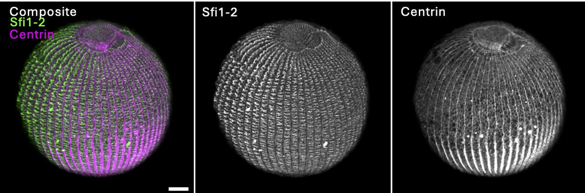 Cells can form patterns within themselves just like embryos do. How? Connie Yan's new preprint shows how the anterior-posterior cytoskeleton pattern in Stentor is dictated by regionalized scaffolding proteins

biorxiv.org/content/10.110…