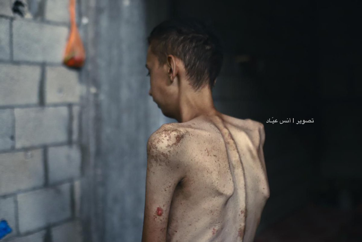 #GazzeÖlüyor #NoFlouninGaza #FreePalestine #GazaNeedsBread