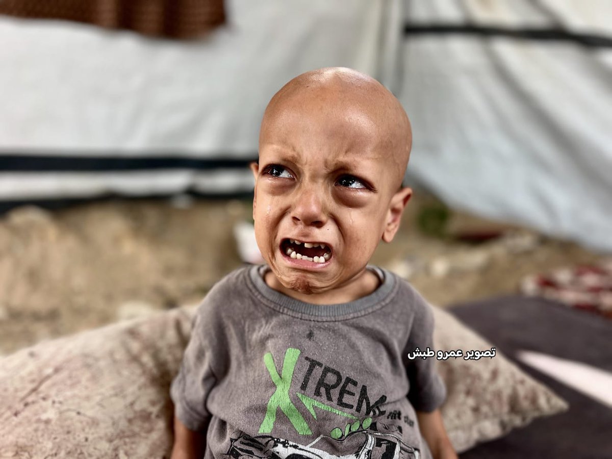 💔 رحيل عبد الله… صرخة "أنا جعان" التي لن تُنسى

ببالغ الحزن نودّع الطفل عبد الله أبو زرقة (5 سنوات)، صاحب الصرخة التي هزّت القلوب: "أنا #جعان".
فارق الحياة اليوم في أحد مستشفيات مدينة أضنا – تركيا، بعد أن تدهورت حالته الصحية نتيجة النقص الحاد في الأدوية والفحوصات والمعدات