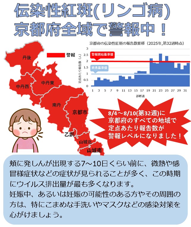 【⚠️京都府全域でリンゴ病が警報レベルに⚠️】

府内での伝染性紅斑（リンゴ病）の報告数が
警報レベルになりました。

頬に発しんが出る7～10日位前の
風邪症状の時期が、最も感染力が高くなります🤧

こまめな手洗いやマスクの着用など
感染対策をお願いします！

詳細⏬
pref.kyoto.jp/idsc/old/palbo…