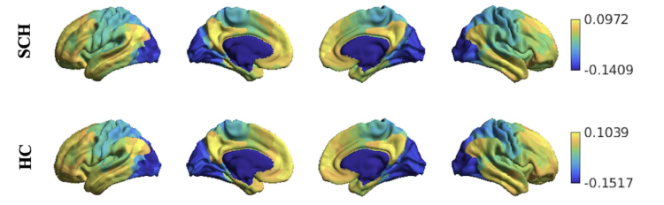 saffetgonul's tweet photo. Our new paper on Disrupted cortical organization in schizophrenia based on functional connectivity gradients has been published https://t.co/TdCZ7dbgvv https://t.co/GDQidWHFFz