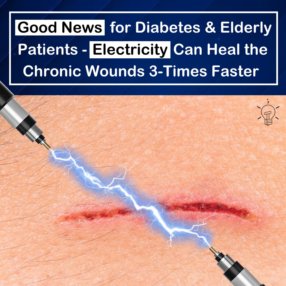 A new study reveals that electricity can significantly accelerate the healing of chronic wounds (three times faster)
Researchers from Chalmers Institute of Technology and the University of Freiburg developed a technique that human skin cells respond to electric fields.