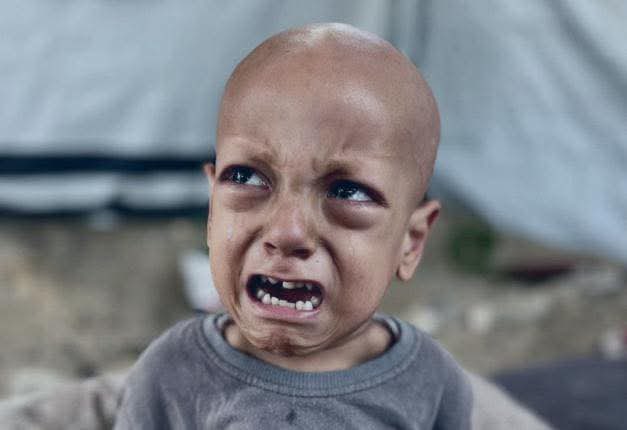 ارتقى في تركيا الطفل عبدالله أبو زرقة 
صاحب عبارة "أنا جعان" والذي ظهر على شاشة الجزيرة في مقطع انتشر على نطاق عالمي 
حيث تم بعد ذلك نقله للعلاج في احدى المستشفيات التركية ليرتقي اليوم .. 
شقيقة عبد الله حبيبة ما تزال في غزة على سرير المرض في حالة حرجة 
فيارب لطفك بها وكل أطفالنا