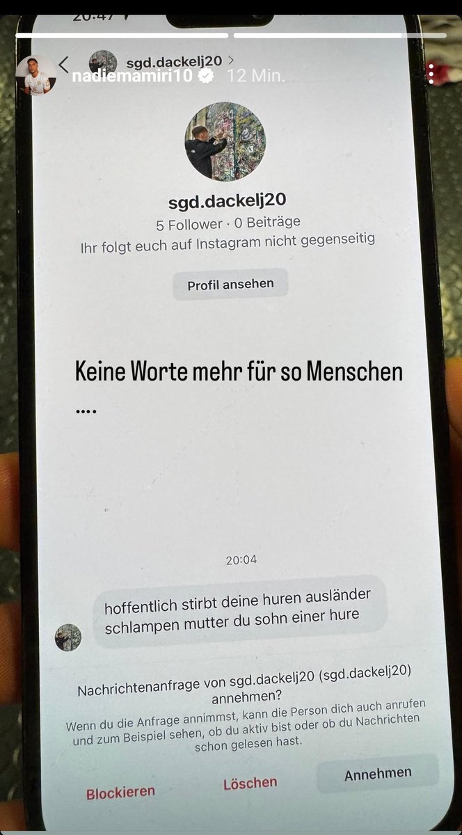 Amiri tu uns allen einen Gefallen..
Zeig dieses dumme Schwein an..

Wie kann man bitte so auf den scheiß Kopf gefallen sein um sowas zu schreiben?!

Rassismus ist einfach Scheiße wann lernen es die Menschen endlich?!