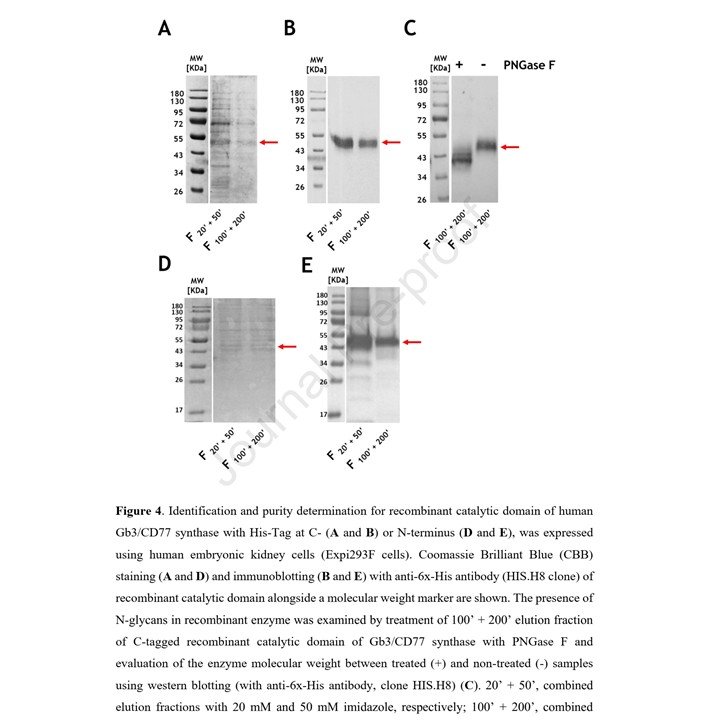 Marcin Czerwinski (@czerwinsmarcin) on Twitter photo New from our lab: <a href="/k_mikolajczyk/">Krzysiek Mikołajczyk</a> <a href="/katszymczak/">Katarzyna Szymczak</a> et al. show which expression system is better for glycosylated proteins: Trichoplusia ni insect cells (High Five) or human embryonic cells (Expi293F). Location of the 6xHis-tag also evaluated.
tinyurl.com/2xkmxtet
#glycotime New from our lab: <a href="/k_mikolajczyk/">Krzysiek Mikołajczyk</a> <a href="/katszymczak/">Katarzyna Szymczak</a> et al. show which expression system is better for glycosylated proteins: Trichoplusia ni insect cells (High Five) or human embryonic cells (Expi293F). Location of the 6xHis-tag also evaluated.
tinyurl.com/2xkmxtet
#glycotime