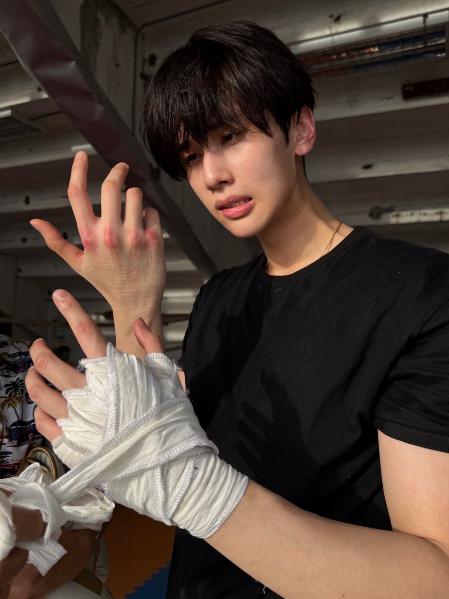 วันแรกก็มีแผลเลย555555