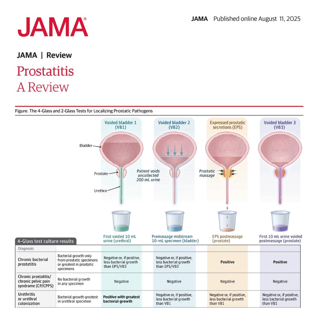 #Prostatitis is defined as infection, inflammation, or pain of the prostate gland and affects approximately 9.3% of men in their lifetime. 

📌 This Review summarizes current evidence on the evaluation and management of prostatitis. 

ja.ma/47Djjsn