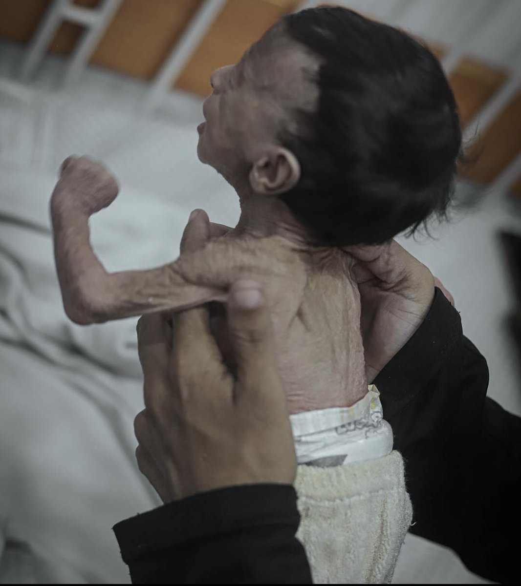 Çocuklar, aç, açıkta, açlıktan ölüyor…
Gazze’de çocuklar, ümmetin imtihanının yansıması.