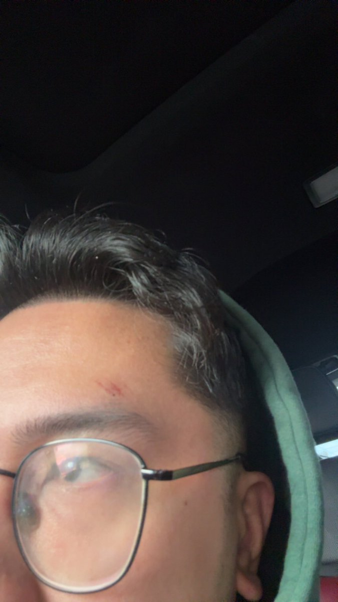 SpellmerR's tweet photo. “How was Bass Canyon”
Oh it was fine, girly pop from my group fell and sat on me now I got a mark on my eyebrow to remember it by 😭
Bass Can-YUN https://t.co/8FIP3Hl879