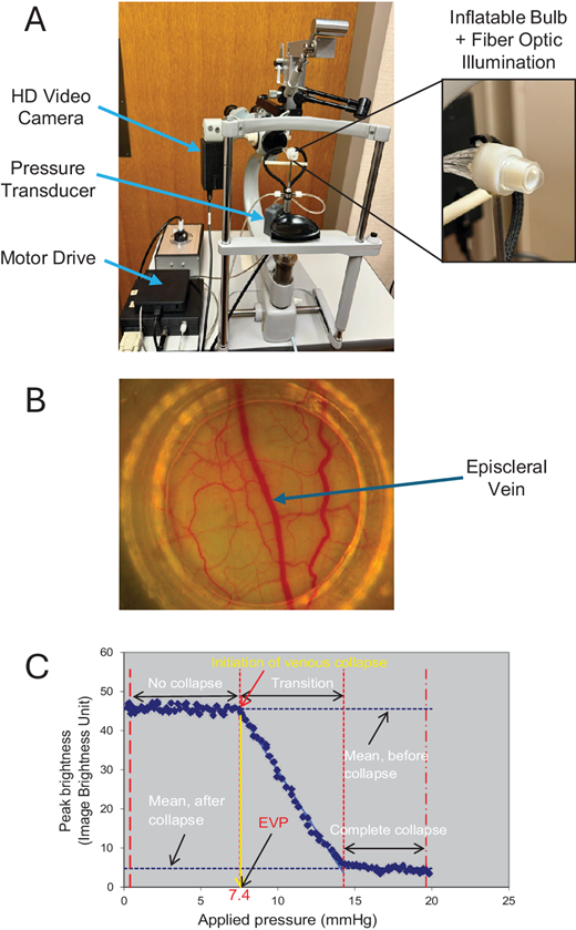 IOVS Journal (@arvoiovs) on Twitter photo Arthur Sit et al. <a href="/MayoClinicEye/">Mayo Clinic Department of Ophthalmology</a> investigate the Relationship Between Diurnal Variations of Episcleral Venous Pressure and Intraocular Pressure, iovs.arvojournals.org/article.aspx?a…. Arthur Sit et al. <a href="/MayoClinicEye/">Mayo Clinic Department of Ophthalmology</a> investigate the Relationship Between Diurnal Variations of Episcleral Venous Pressure and Intraocular Pressure, iovs.arvojournals.org/article.aspx?a….