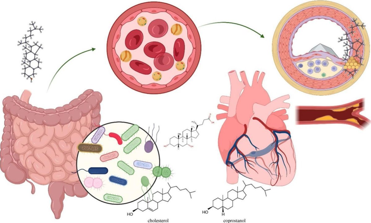 MahmoudiLab (@mahmoudilab) on Twitter photo Linking #gut, #heart and #metabolic #health through cholesterol conversion by Akkermansia muciniphila sciencedirect.com/science/articl…
<a href="/Chem_Eng_J/">Chemical Engineering Journal</a> <a href="/MSUMD/">MSU College of Human Medicine</a> <a href="/MoriMahmoudi/">Morteza Mahmoudi, PhD</a> <a href="/avirupguha/">Avirup Guha, MBBS, MPH, FICOS, FACC, FAHA, FESC</a>
<a href="/Pakpourlab/">Pakpour Laboratory</a> Linking #gut, #heart and #metabolic #health through cholesterol conversion by Akkermansia muciniphila sciencedirect.com/science/articl…
<a href="/Chem_Eng_J/">Chemical Engineering Journal</a> <a href="/MSUMD/">MSU College of Human Medicine</a> <a href="/MoriMahmoudi/">Morteza Mahmoudi, PhD</a> <a href="/avirupguha/">Avirup Guha, MBBS, MPH, FICOS, FACC, FAHA, FESC</a>
<a href="/Pakpourlab/">Pakpour Laboratory</a>