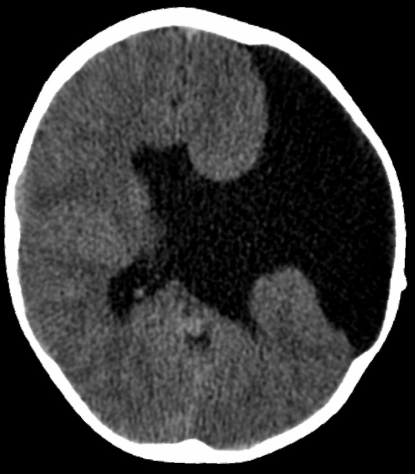 Neuromed_'s tweet photo. Your diagnosis!!! https://t.co/Aayq6Yeub6
