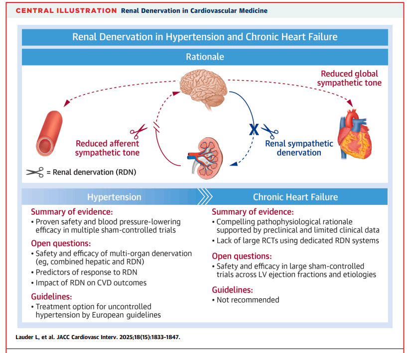 Pam R. Taub, MD❤️💃🏻 (@pamtaubmd) on Twitter photo Congrats to Lucas Lauder and <a href="/FelixMahfoud/">Felix Mahfoud</a> for leading this article highlighting the future of renal denervation for heart failure management and the role of multiorgan denervation (renal and hepatic) for management of cardiometabolic disease. jacc.org/doi/10.1016/j.… Congrats to Lucas Lauder and <a href="/FelixMahfoud/">Felix Mahfoud</a> for leading this article highlighting the future of renal denervation for heart failure management and the role of multiorgan denervation (renal and hepatic) for management of cardiometabolic disease. jacc.org/doi/10.1016/j.…