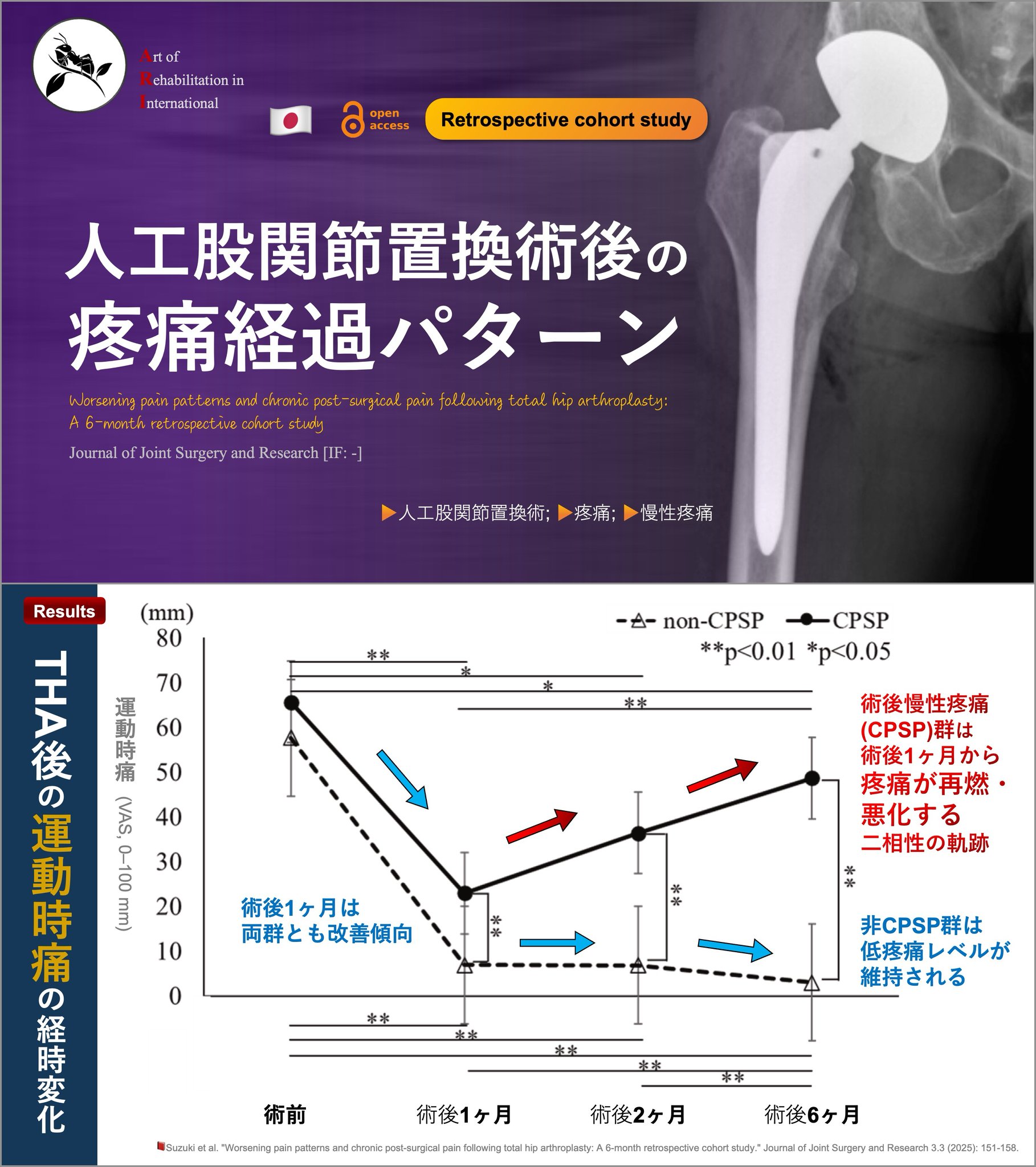がんの痛みからの解放とパリアティブ・ケア Amazon.co.jp: がんの痛みからの解放とパリアティブ・ケア