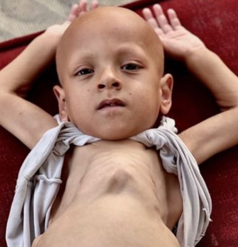 Açlıktan ağladığı video ile tanınan Gazzeli kanser hastası küçük Abdullah, Türkiye’ye tahliye olduktan kısa bir süre sonra vefat etti.

İsrail’in zalim ablukası yüzünden tedavisinden ve gıdadan öyle uzun süre mahrum kalmıştı ki; Türkiye’de gördüğü tedavi onu hayata bağlayamadı.