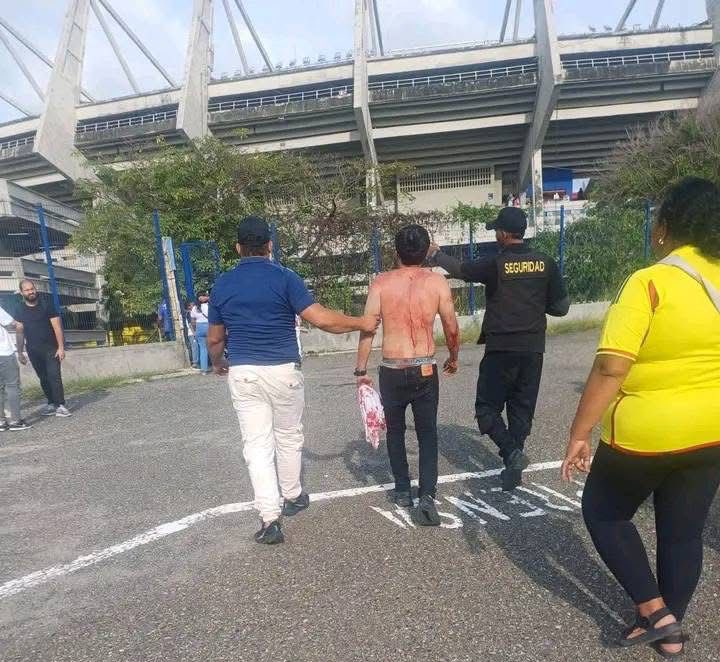 Alexander Rojas Agudelo (@alexanderojasa) on Twitter photo 🚨DENUNCIA PÚBLICA🚨
Ayer mi primo fue atacado por 20 personas de las “barras bravas” del <a href="/JuniorClubSA/">Junior FC</a>.
Más de 10 puñaladas en cara y cuerpo. NO había Policía cerca del estadio y <a href="/PoliciaColombia/">Policía de Colombia</a>, y <a href="/FiscaliaCol/">Fiscalía Colombia</a> se niegan a recibir la denuncia.
Exigimos justicia y protección! 🚨DENUNCIA PÚBLICA🚨
Ayer mi primo fue atacado por 20 personas de las “barras bravas” del <a href="/JuniorClubSA/">Junior FC</a>.
Más de 10 puñaladas en cara y cuerpo. NO había Policía cerca del estadio y <a href="/PoliciaColombia/">Policía de Colombia</a>, y <a href="/FiscaliaCol/">Fiscalía Colombia</a> se niegan a recibir la denuncia.
Exigimos justicia y protección!