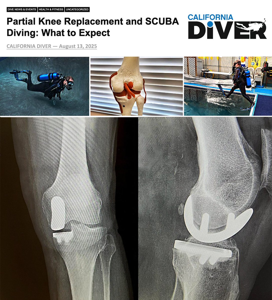 EPEDivers's tweet photo. Our latest published article can be viewed in California Diver Magazine.

>>> Partial Knee Replacement and SCUBA Diving: What to Expect

Read the article at:
https://t.co/5rDl8iZdJI

https://t.co/Ro7P6ZbkSs

Subscribe to California Diver Magazine at:
https://t.co/R7wXMfq6zy https://t.co/LYFEX62829