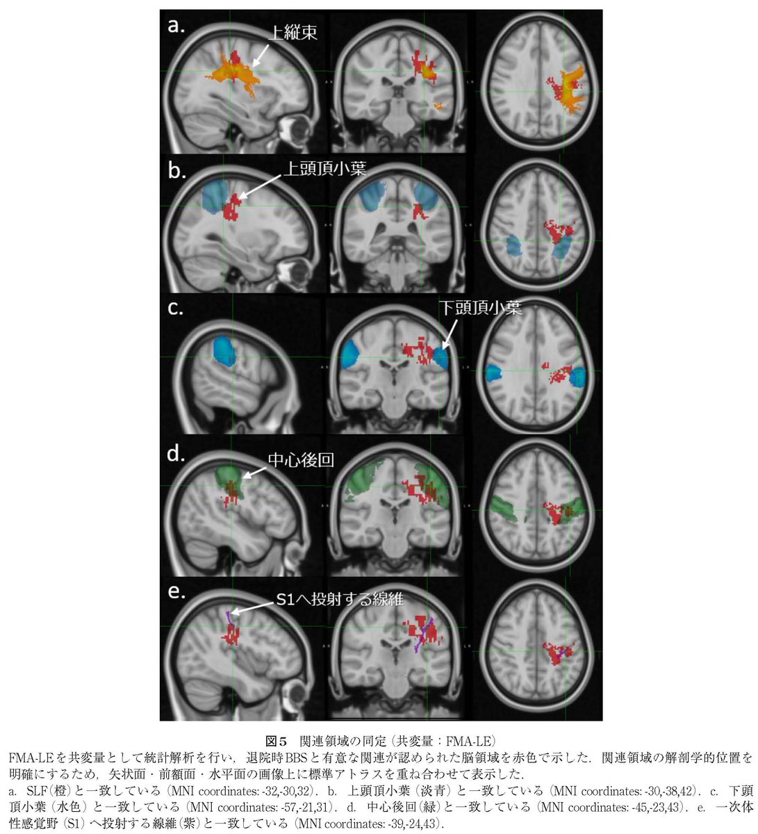 #理学療法学 52巻4号掲載論文紹介

研究論文（原著）- 脳卒中患者のバランス機能と関連する脳領域—Support Vector Regression-lesion Symptom Mappingによる解析—

doi.org/10.15063/rigak…     

#脳卒中 #バランス #SupportVectorRegressionLesionSymptomMapping