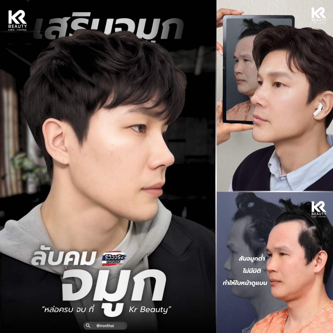 bananapsth's tweet photo. สันจมูกเป๊ะ หน้าเข้มขึ้นหลายระดับ 
จมูกที่ใช่ เลือกที่ Kr Beauty เท่านั้น

สนใจทักเลยค่า
Line id : @ironthai
FB : https://t.co/I1L17Xyuu6
KR : +82 10-3453-8188
TH: +66 81-258-7372
 https://t.co/yc9t65IShP
#krbeauty #ศัลยกรรม #ศัลยกรรมเกาหลี #อารึมออนนี่ https://t.co/5PYFzBDORf