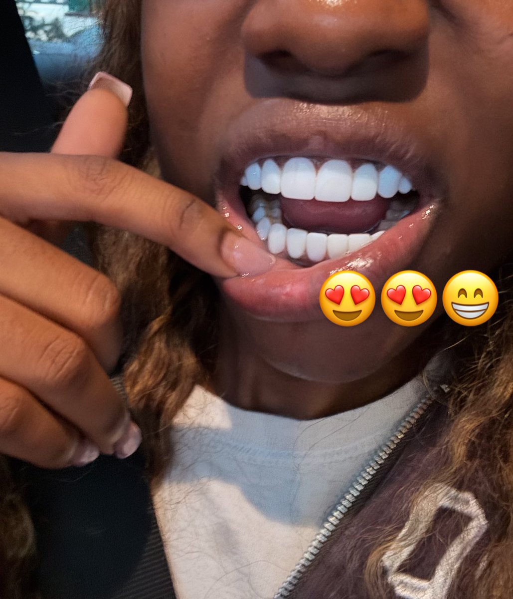 amourfee_'s tweet image. Had to go pearly before my birthday 🤏🏾