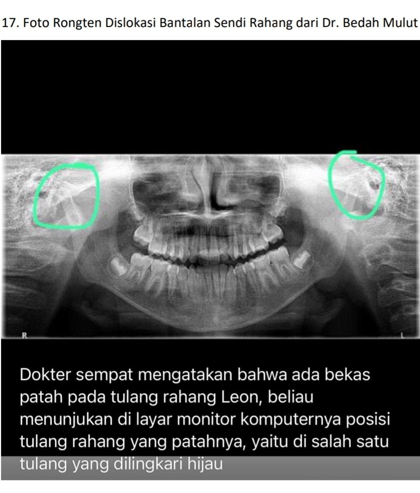 dudy syahprialdi tweet media