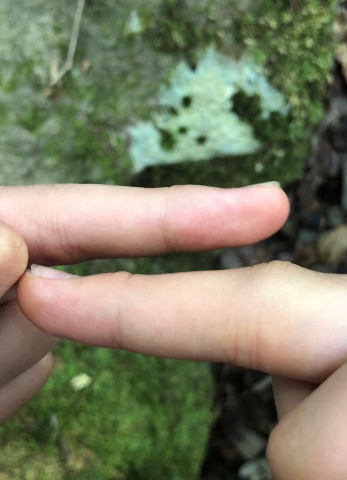 ヒバカリは無毒って言われてるけど絶対に後牙に毒がある。
中指を後牙で噛まれたけどものの10分で思いっきり腫れた。指動かん。