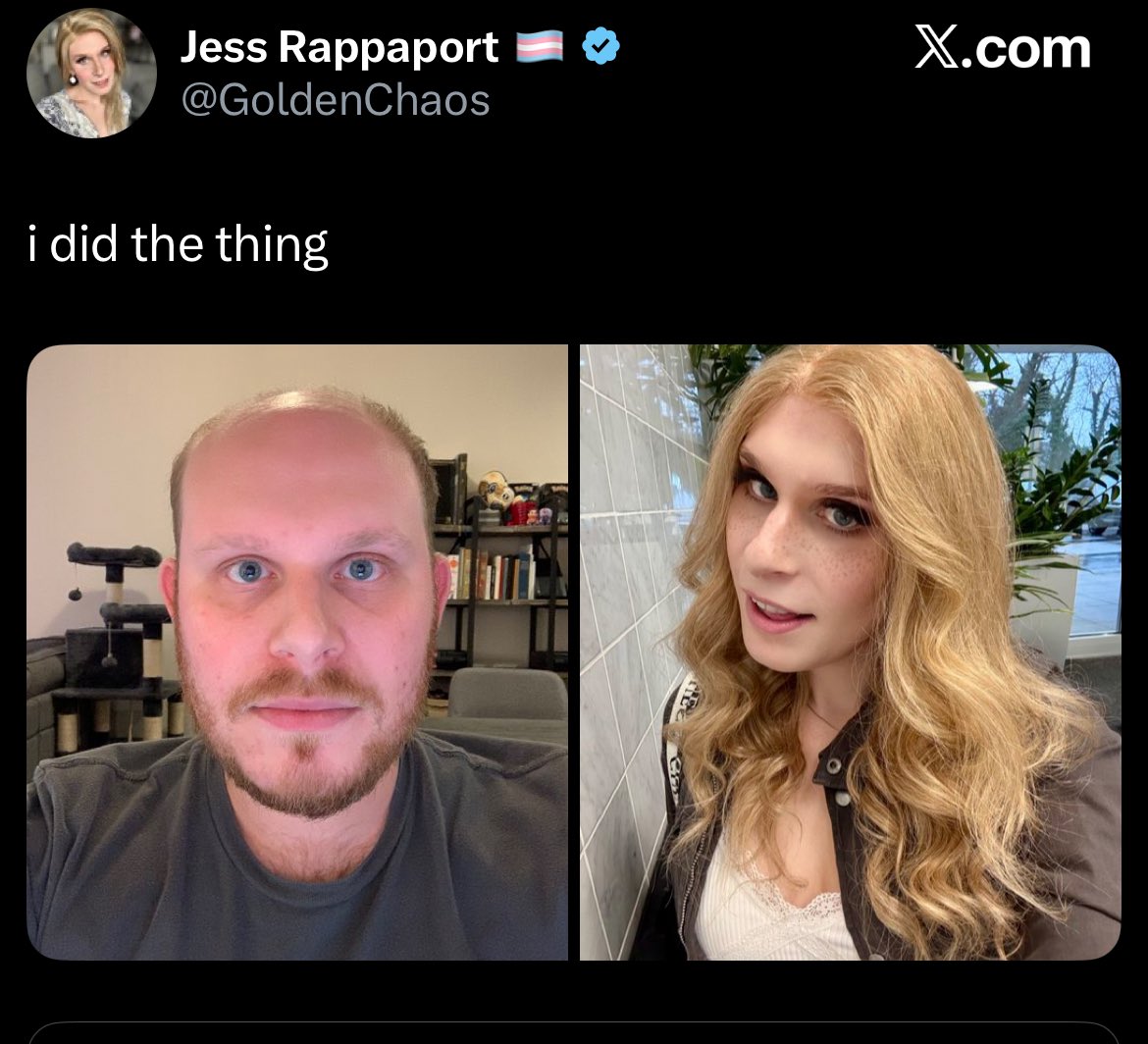 Balding guys would rather troon out than wear a toupee