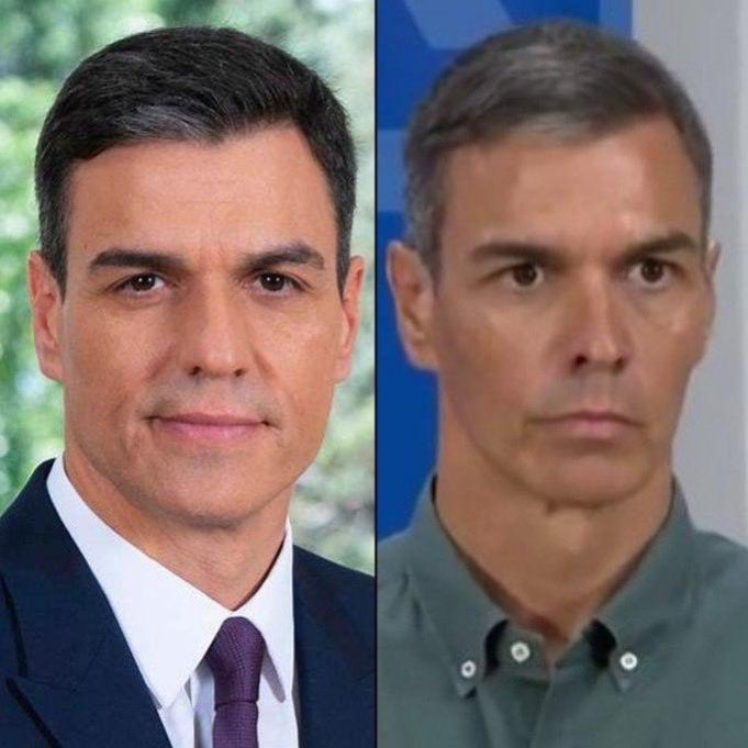 🔴 ¿Qué le ha ocurrido a este hombre?