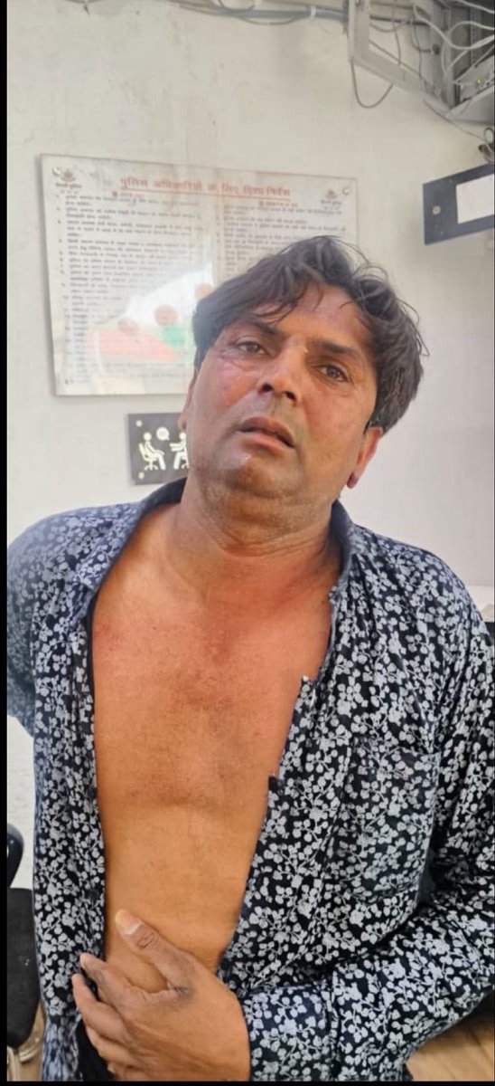 आप का कार्यकर्ता है ये हमलावर