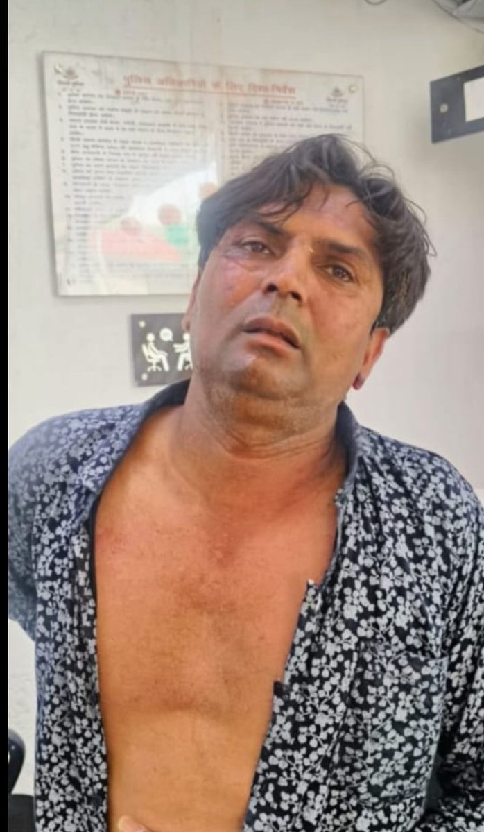 Pankaj (@tpankaj001) on Twitter photo दिल्ली मुख्यमंत्री रेखा गुप्ता पर हमला करने वाला कटहा कुत्ता प्रेमी निकला! दिल्ली मुख्यमंत्री रेखा गुप्ता पर हमला करने वाला कटहा कुत्ता प्रेमी निकला!