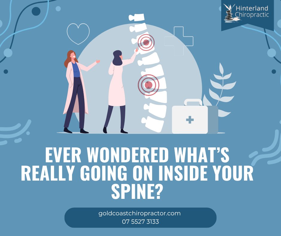 Thermography lets us see beyond the surface by measuring tiny heat differences along your spine. These heat patterns can reveal how your nervous system is functioning!
Call: 07 5527 3133
goldcoastchiropractor.com
#Thermography #ChiropractorGoldCoast #ChiropracticGoldCoast