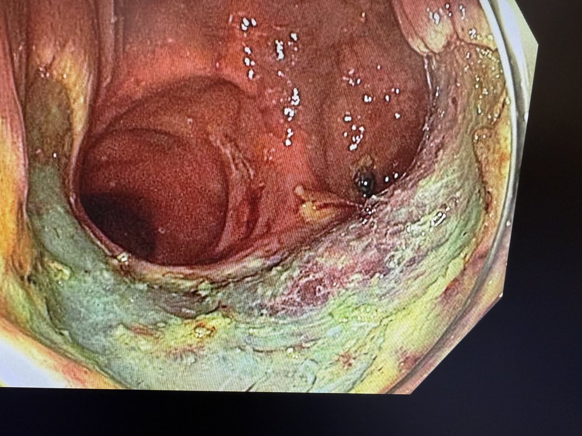 Benjamin Tharian tweet media