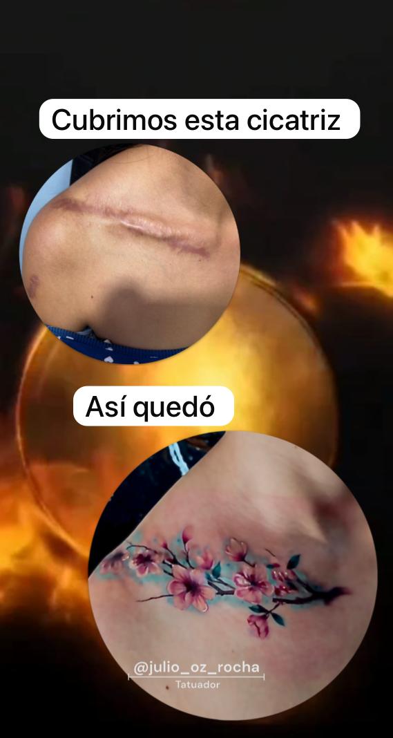 Cicatrices?
¿Tienes alguna cicatriz que quieras cubrir con un tatuaje? 💫
En nuestro estudio somos expertos en este tipo de trabajos, con un enfoque artístico y profesional que transforma marcas en piezas de arte.
Acércate para más información, estaremos felices de ayudarte.