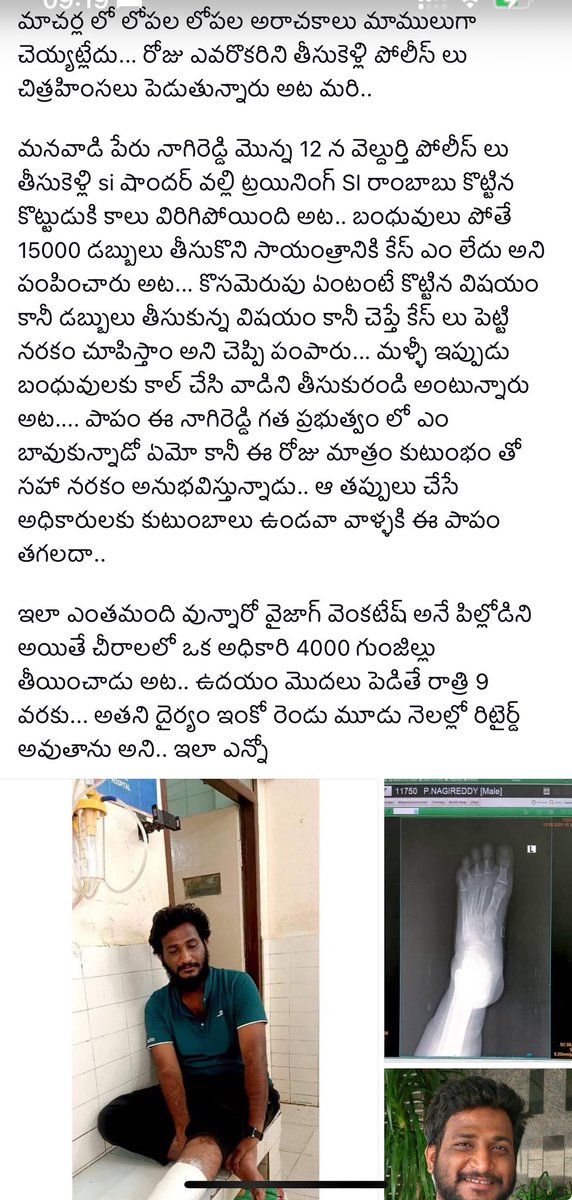 YSRCPResurgence's tweet photo. పోలీసులు అరాచకాలుకు బలి అవుతున్న వారిలో ఇంకొకరు.
#SaveAP #SaveAPFromTDP #SaveAPFromKutami #AndhraPradesh #Redbook #Macharla #Palnadu #IdiMunchyPrabhuthvam #Corruption https://t.co/fFJa0BCss1