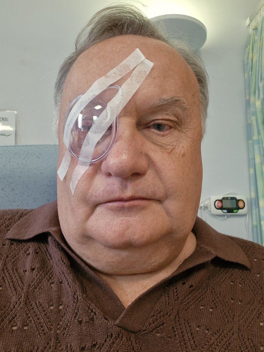 Just out of cataract surgery, All went well
