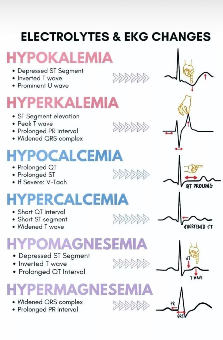 📈Your ECG speaks :
⚡️HypoK → U wave pops; HyperK → sharp T wave;
⏰HypoCa → QT prolonged; HyperCa → QT shortened;
✂️HypoMg → QT prolonged; HyperMg → QRS &amp; PR widened.
📏Remember these "electrolyte fingerprints", they can save lives at critical moments!❤️