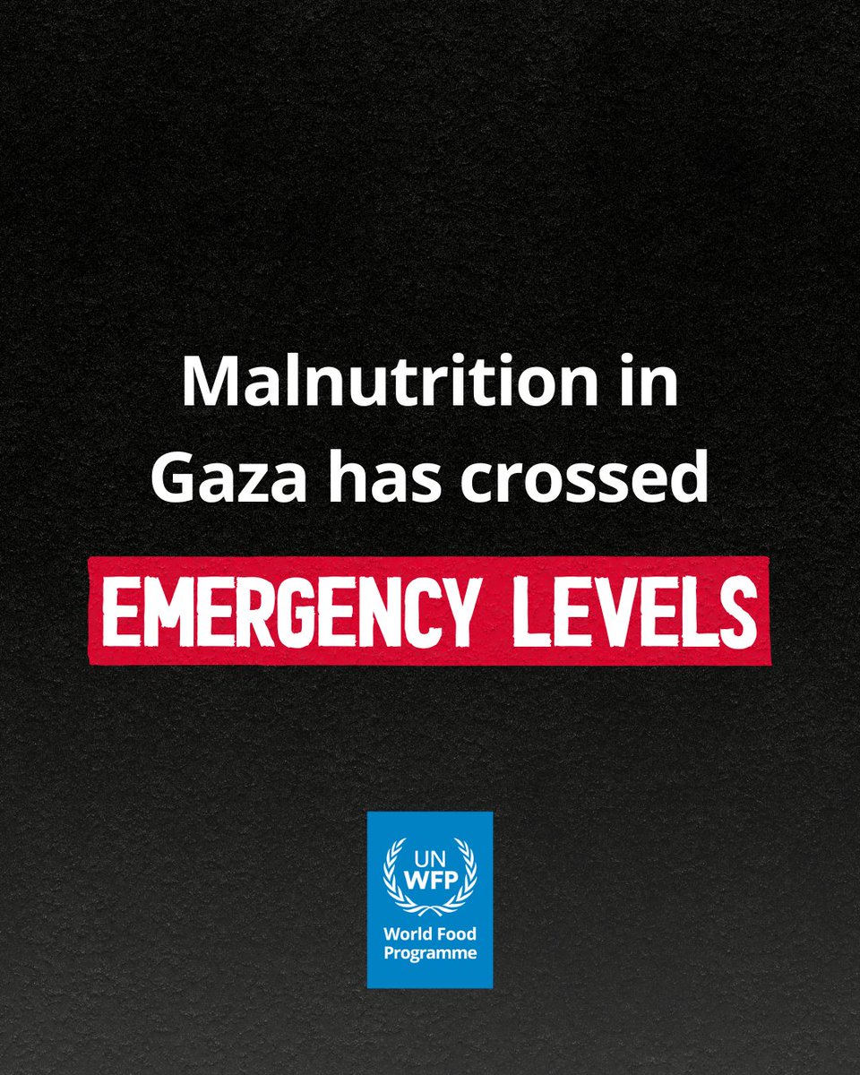 World Food Programme (@wfp) on Twitter photo This isn't just hunger. This is starvation.
Malnutrition in #Gaza is rising fast - with more children and mothers showing severe signs.
Malnutrition is a silent killer:
🔴 Weakens immune systems, making common illnesses deadly
🔴 Causes stunting & lifelong developmental damage This isn't just hunger. This is starvation.
Malnutrition in #Gaza is rising fast - with more children and mothers showing severe signs.
Malnutrition is a silent killer:
🔴 Weakens immune systems, making common illnesses deadly
🔴 Causes stunting & lifelong developmental damage