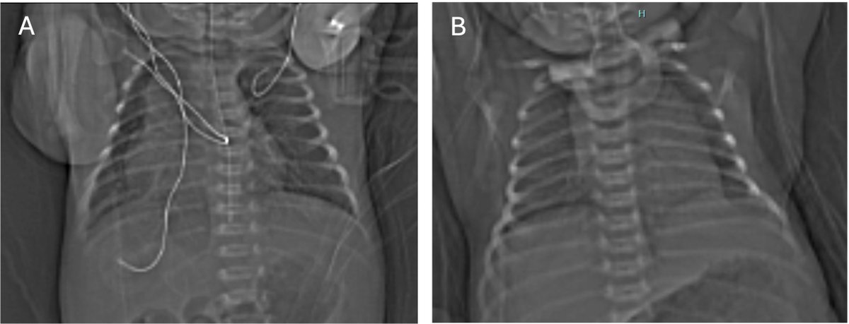 David Tingay tweet media