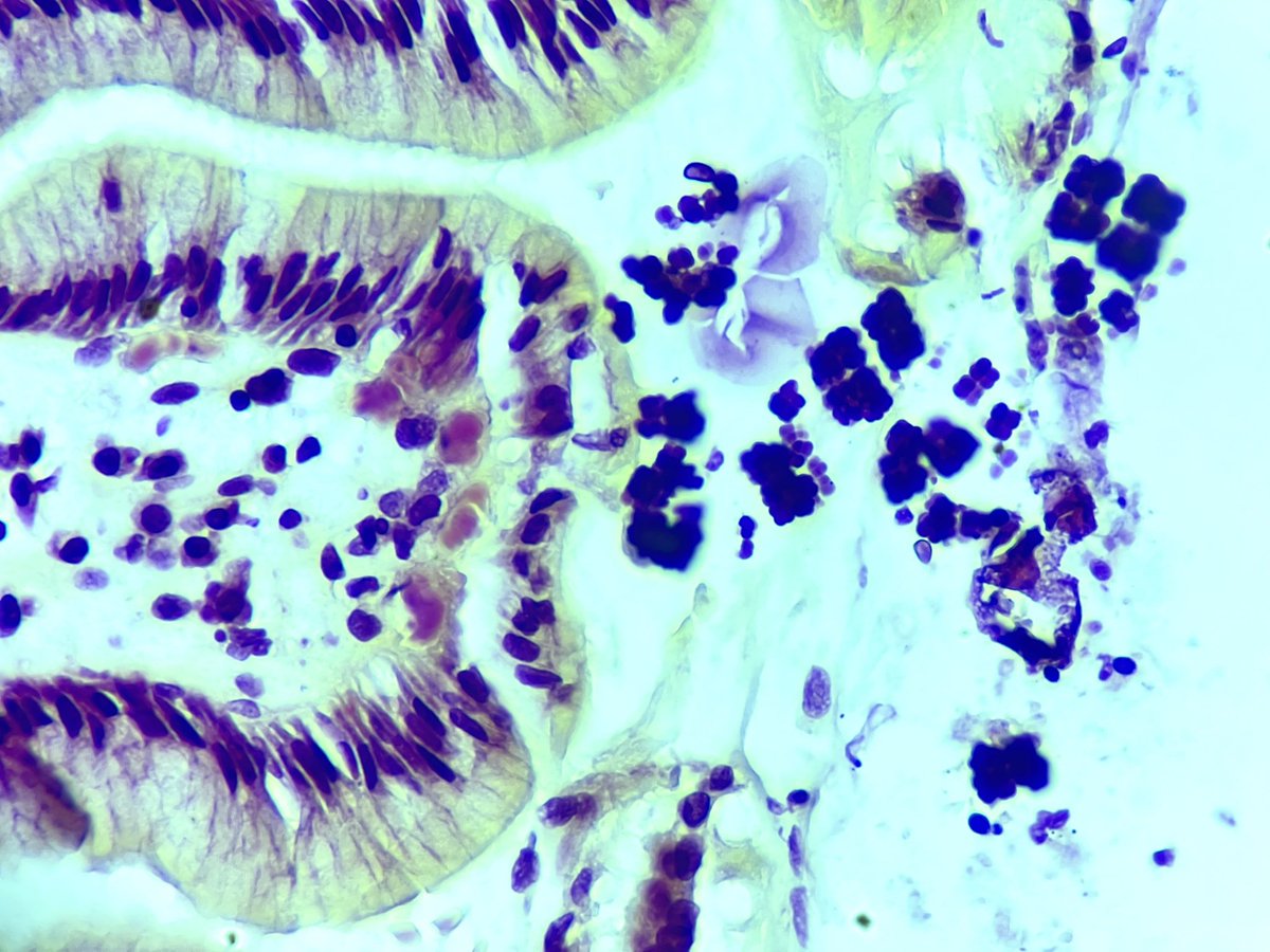 Gastric biopsy. Nice example.