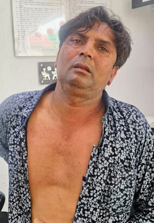 Mohit Aggarwal Bjp (@mohitag87136544) on Twitter photo मुझे तो आपका ये शक बेशक सही दिखता है <a href="/HarishKhuranna/">Harish Khurana</a> जी!
यह कथाकथित कुत्ताप्रेमी नहीं यह बहुत बड़ा हिस्ट्रीशीटर है
जिसने रेखा गुप्ता जी के ऊपर जानलेवा हमला किया है।
सीसीटीवी से पता चला कि यह एक दिन पहले से दिल्ली सीएम के घर की रेकी कर रहा था…
यह अपराध अक्षम्य है मुझे तो आपका ये शक बेशक सही दिखता है <a href="/HarishKhuranna/">Harish Khurana</a> जी!
यह कथाकथित कुत्ताप्रेमी नहीं यह बहुत बड़ा हिस्ट्रीशीटर है
जिसने रेखा गुप्ता जी के ऊपर जानलेवा हमला किया है।
सीसीटीवी से पता चला कि यह एक दिन पहले से दिल्ली सीएम के घर की रेकी कर रहा था…
यह अपराध अक्षम्य है