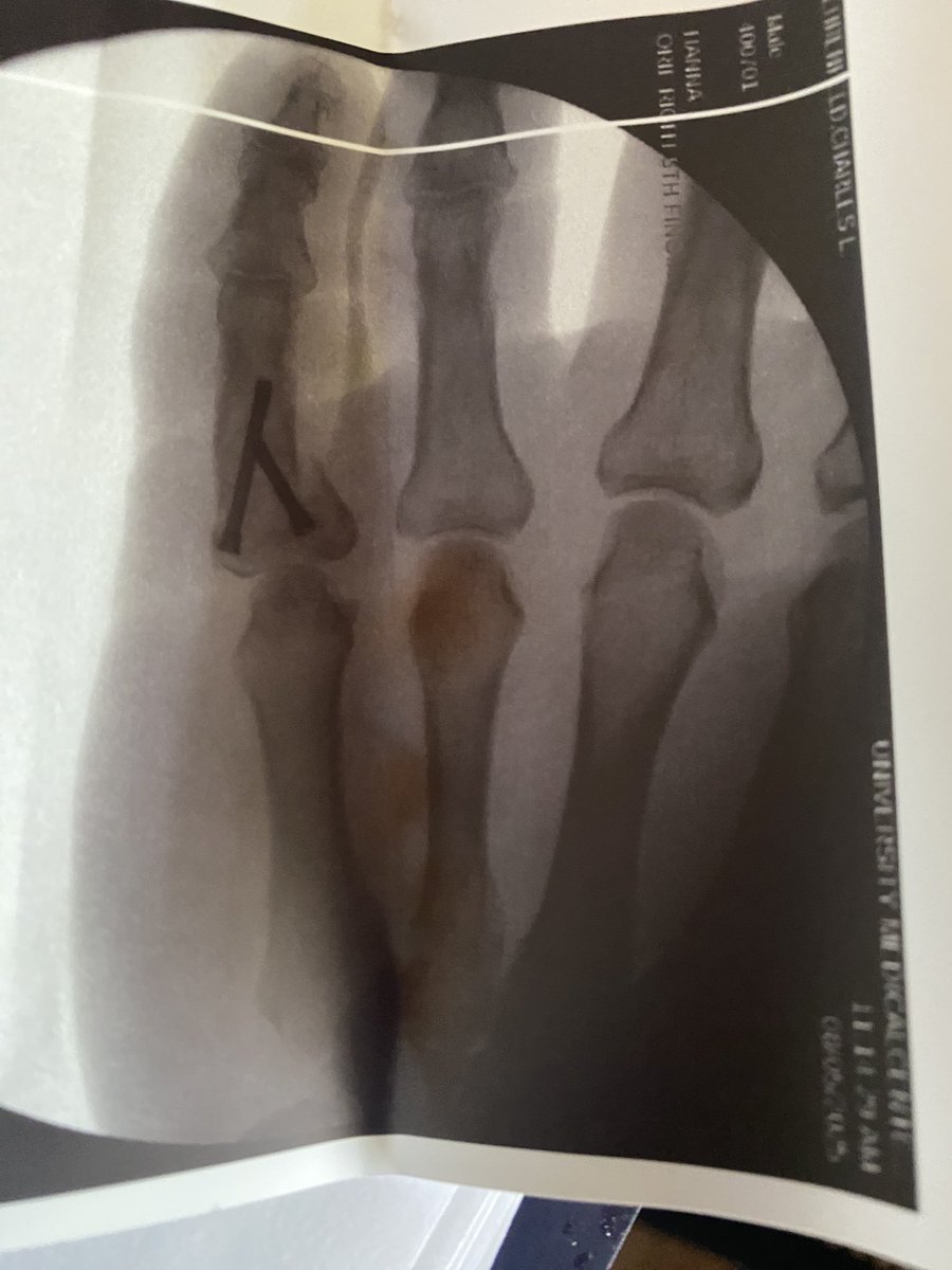 New hand hardware, added two weeks ago! … So over 2025!