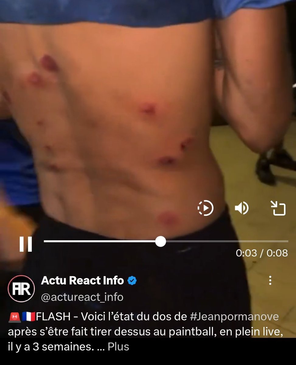 Tristan8712448's tweet photo. @AlertesInfos Faut le comprendre, Naruto a perdu son souffre douleur et sa tirelire. https://t.co/LDO8t1wDI1
