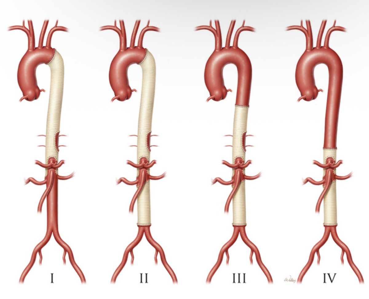 Miroslav P. Peev, MD FACS FACC tweet media