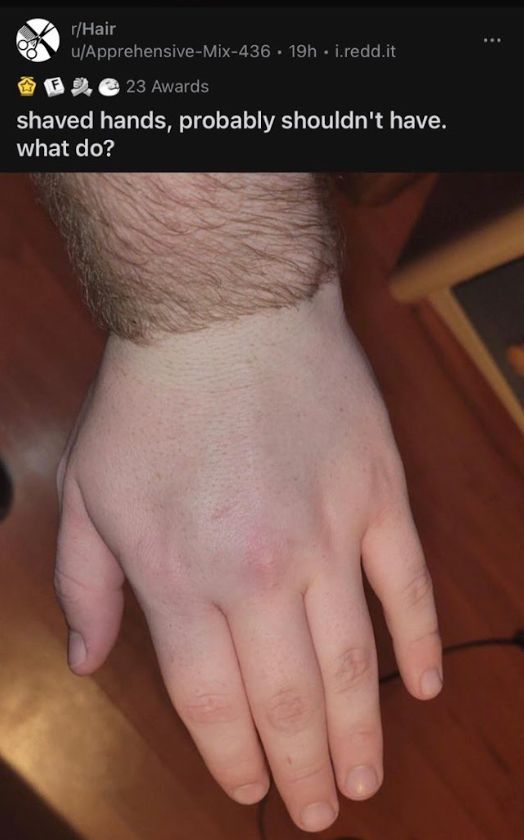 RedditStrange's tweet image. 