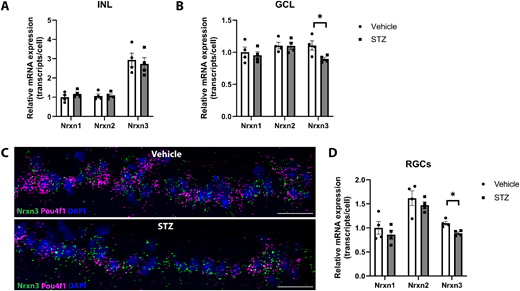 IOVS Journal (@arvoiovs) on Twitter photo Mira Sachdeva et al. <a href="/HopkinsMedicine/">Johns Hopkins Medicine</a> investigate Differential Expression of the Synapse Regulatory Proteins Neurexins in Early Diabetic Retinal Disease, iovs.arvojournals.org/article.aspx?a…. Mira Sachdeva et al. <a href="/HopkinsMedicine/">Johns Hopkins Medicine</a> investigate Differential Expression of the Synapse Regulatory Proteins Neurexins in Early Diabetic Retinal Disease, iovs.arvojournals.org/article.aspx?a….