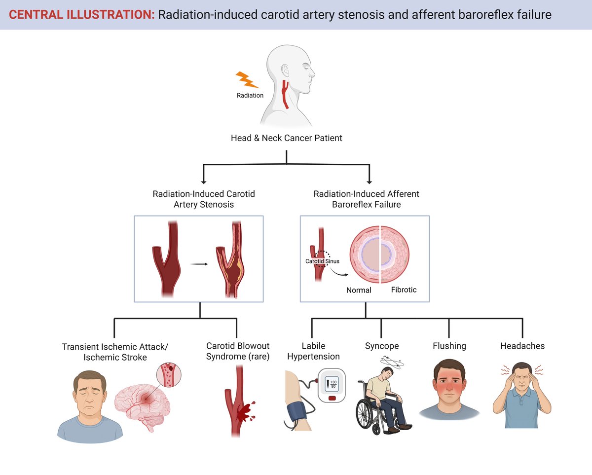 ACCinTouch's tweet image. As survival rates for patients w/ head &amp;amp; neck cancer continue to improve, clinical focus must expand beyond tumor control to encompass long-term CV &amp;amp; autonomic complications such as RICAS &amp;amp; RABF.

Learn more: bit.ly/3Jn5vIw #CardioOnc