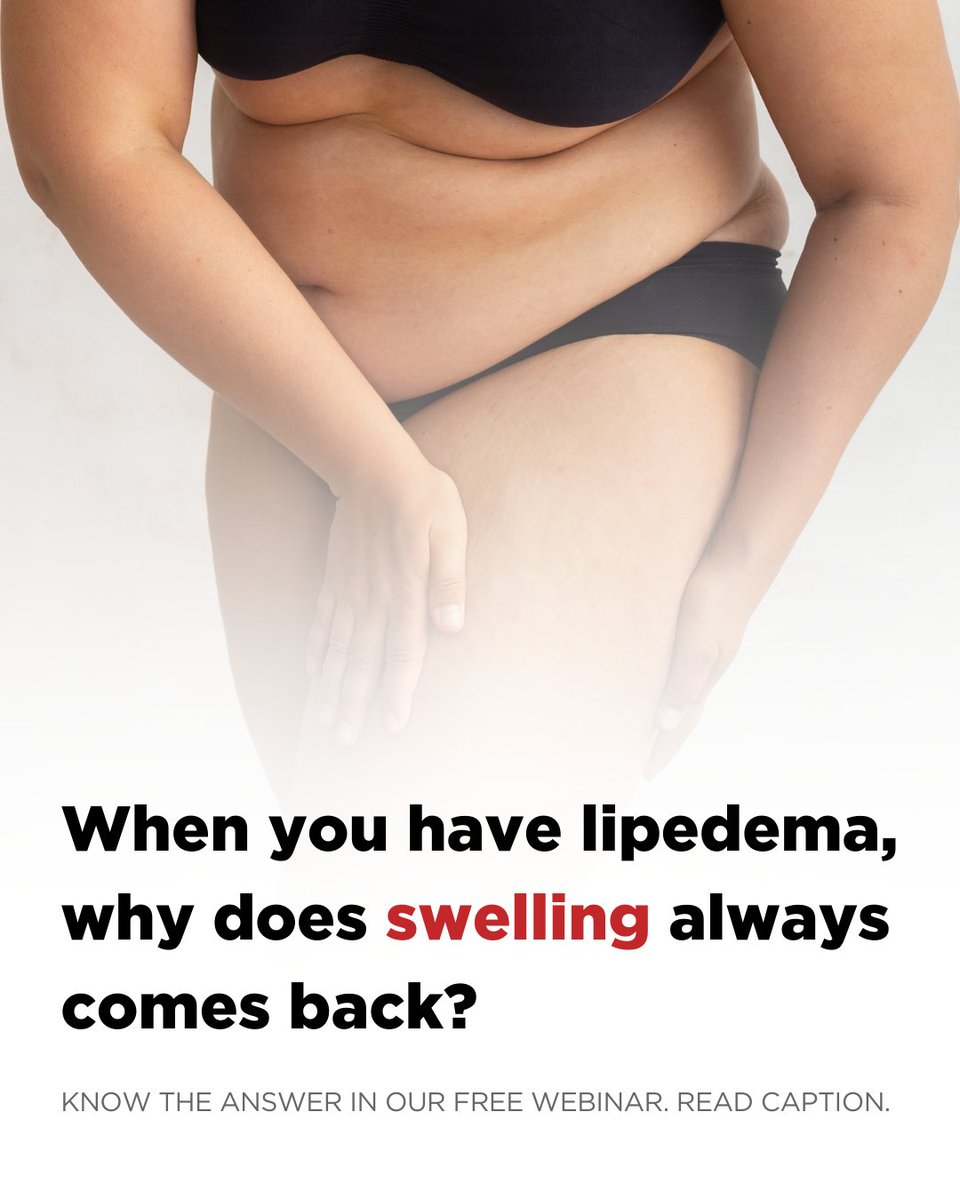 When you have lipedema, why does the swelling always come back? In this FREE webinar, you’ll learn why. Monday, August 25, 2025 3PM EDT. Register here: learn.lipedema-simplified.org/free-webinar 
#lipedemawebinar #lipedemasimplified