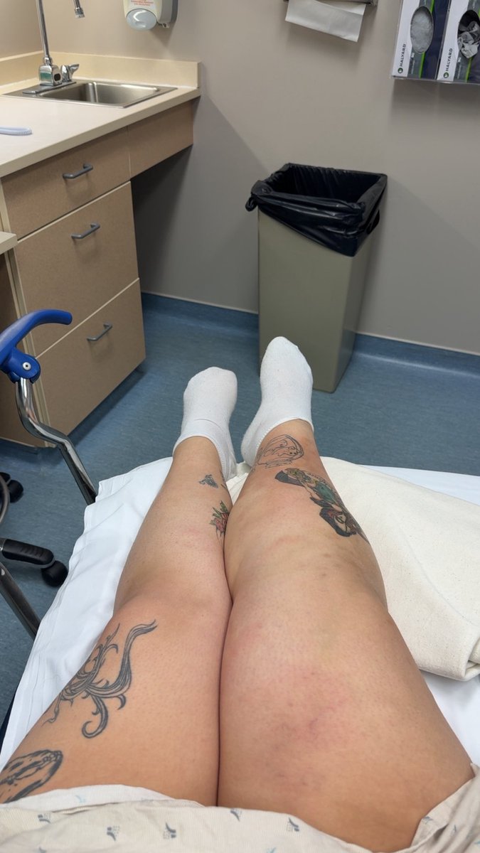 UNDR | SleepyLeti tweet media